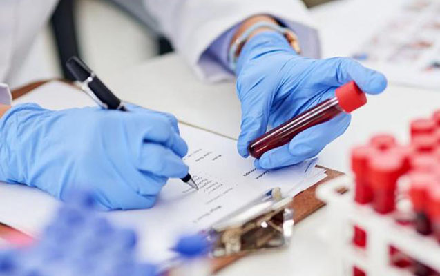 COVID-19 keçirmiş şəxslər donor ola bilər?